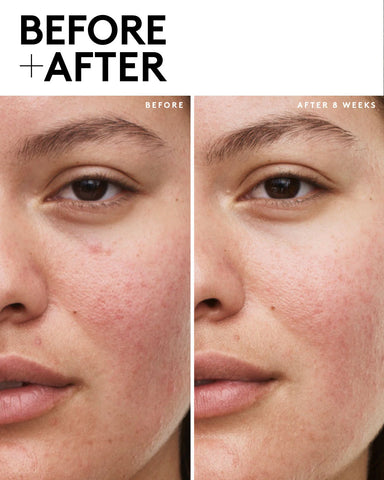 Fenty Skin Vault 5-Piece AM + PM Skincare Essentials