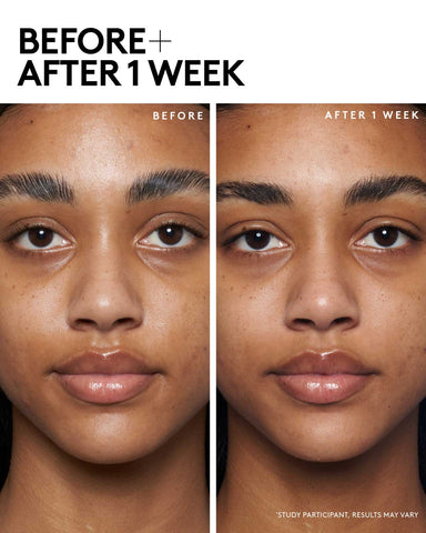 Cherry Dub Blah 2 Bright 5% AHA Face Mask